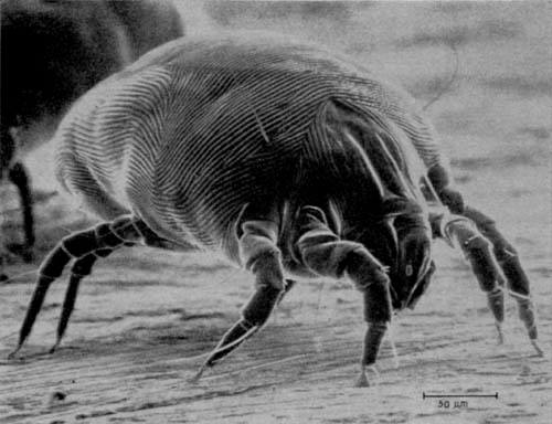 What Are Dust Mites?
